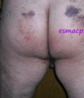 esmac pictures