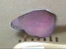 CBT in Gloryhole