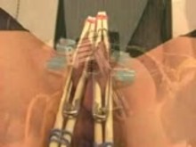 Pussy Needle torture