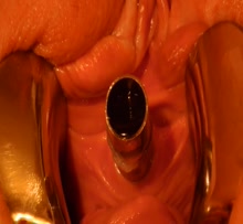 Peehole Insertion - Homemade