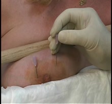 Needle torture for fat pig