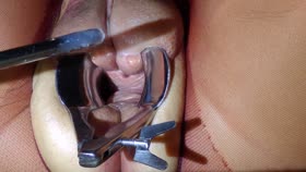 Peehole Torture