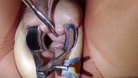 Peehole torment