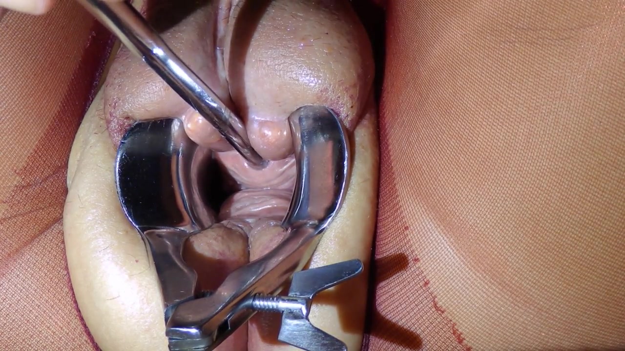 Peehole torment