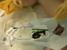 Insertion of male catheter - painful!