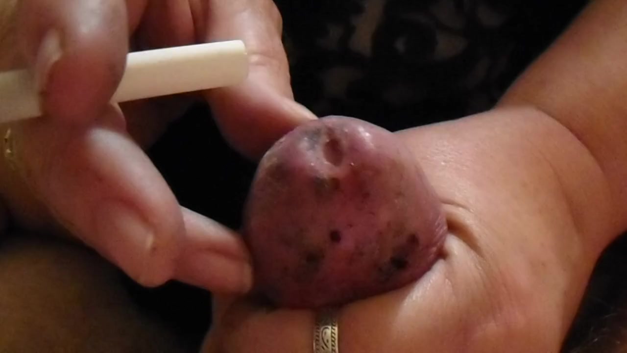 Cigarette CBT