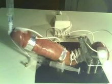 CBT With Electro torture