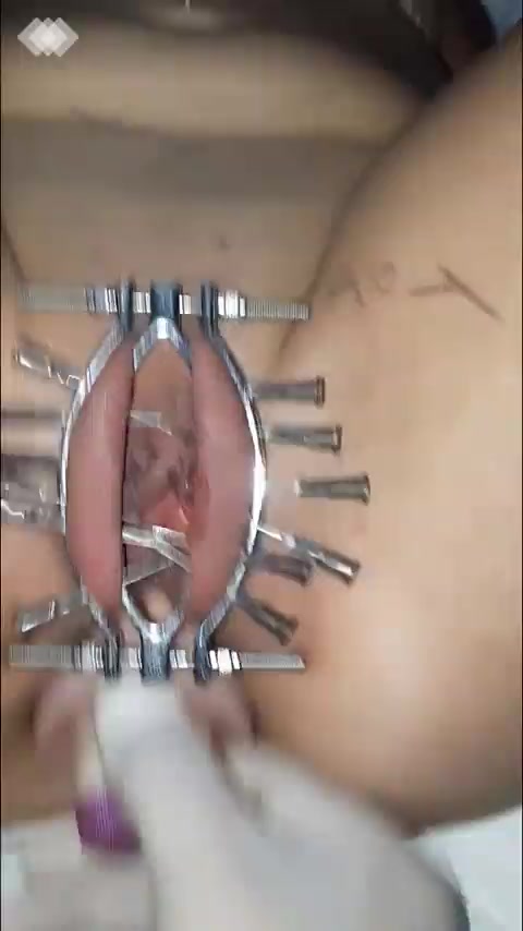 Anal Fisting With Needles In Her Pussy Masochist Enjoys A Lot