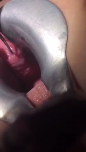 Xtreme Needle Play Gynecology