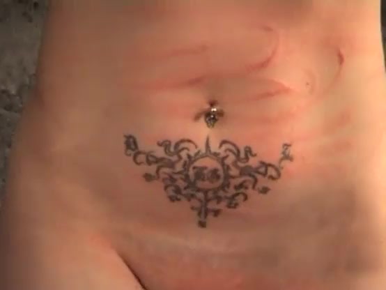 Elite Pain Case 5