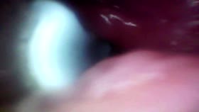 Recorded close-up of a woman's G-spot (the camera probe goes deep into her)