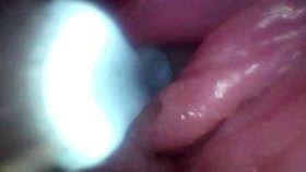 Recorded close-up of a woman's G-spot (the camera probe goes deep into her)